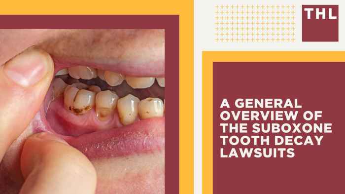 Statute Of Limitations For Suboxone Lawsuits Explained | TorHoerman Law